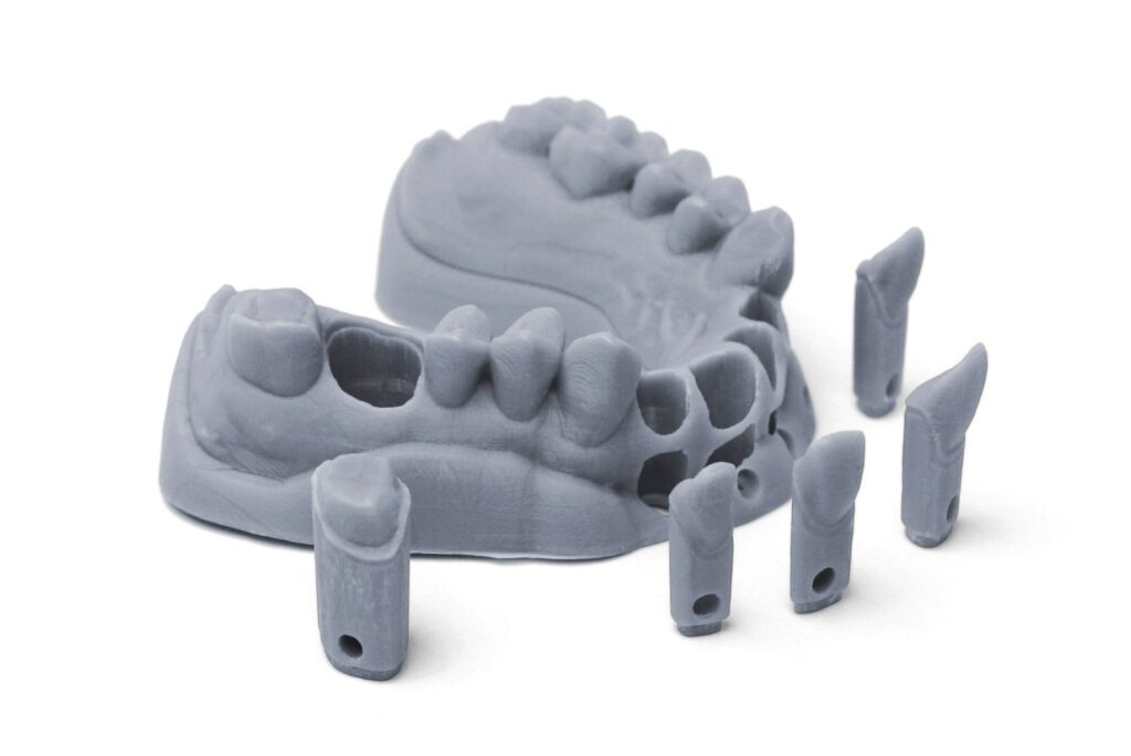 dental 3d printing