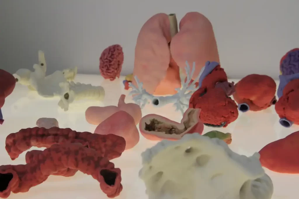 medical Prototype