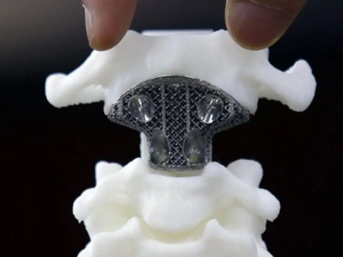 Exploring the Growth of the SLA 3D Printing Market: Trends, Challenges, and Future Opportunities 3dkosti 1160x871 1