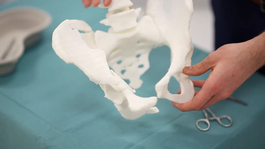 What is the Difference Between PLA and SLA? dlp 3d printing for medical
