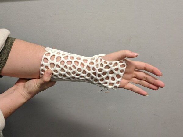 SLS 3D Printing Services: The Path to Create Durable Components sla for orthotics